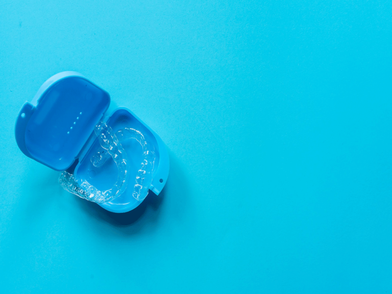 clear aligners in a blue case